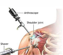 Shoulder Anatomy, shoulder replacement surgeon near me, best shoulder surgery in Pune