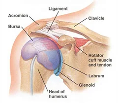 Labrum and rotator cuff tear, best shoulder surgery in Pune, shoulder treatment recovery